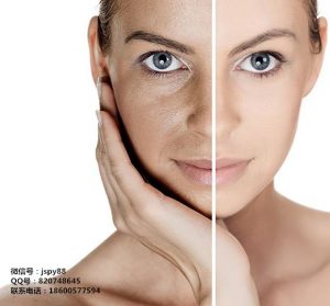 激素脸上的斑斑、肤色暗沉是怎样形成的？怎么可以排除毒素？